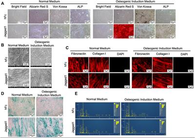Effects of <mark class="highlighted">decellularized extracellular matrix</mark> derived from Jagged1-treated human dental pulp stem cells on biological responses of stem cells isolated from apical papilla